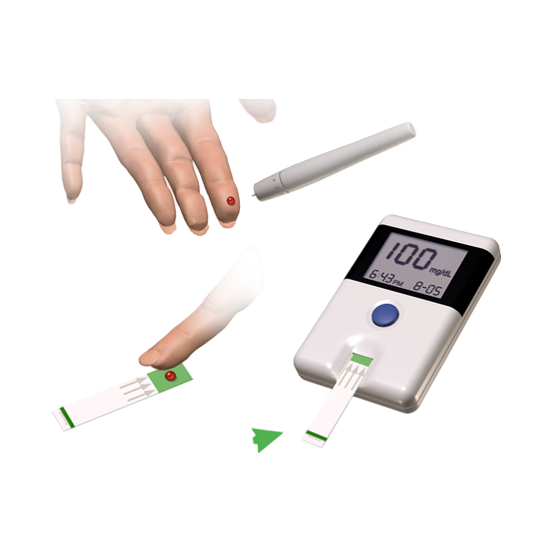 CGM